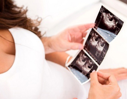 Cuidados a tener en cuenta luego de la inseminación artificial ... Cuidados a tener en cuenta luego de la inseminación artificial ...