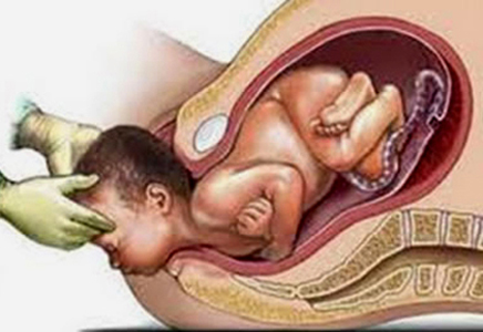 reflejo de eyección fetal