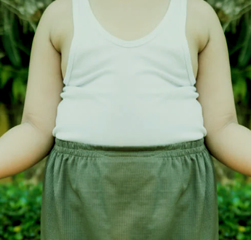 Enfermedades relacionadas con la obesidad infantil