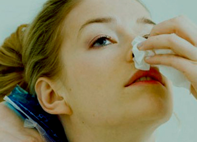 Hemorragias nasales en los niños
