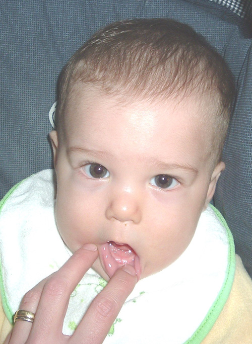 7 Meses Y 11 Dias Ya Se Ven Los Dientitos C Embarazo Y Maternidad 7 Meses Y 11 Dias Ya Se Ven Los Dientitos C Embarazo Y Maternidad